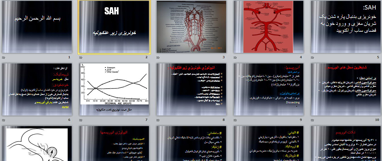 پاورپوینت خونريزی زیر عنكبوتيه