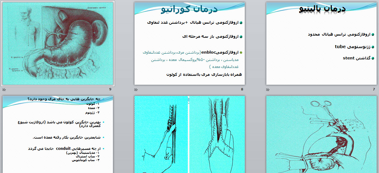 پاورپوینت جایگاه جراحی در کانسر مری