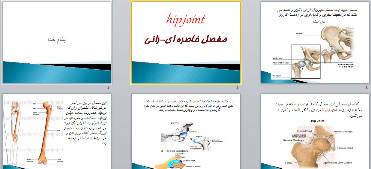 پاورپوینت مفصل خاصره ای-رانی