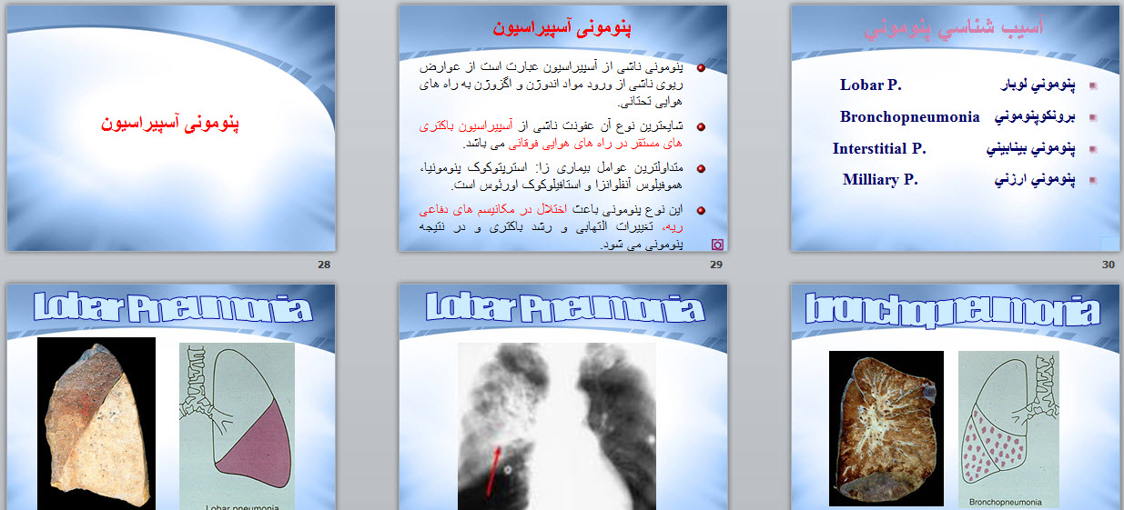 مشكلات راه های هوايی تحتانی