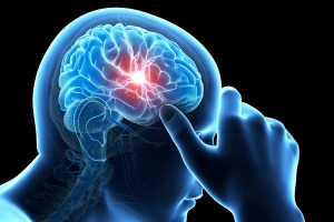 پیشگیری و درمان سردرد های عصبی