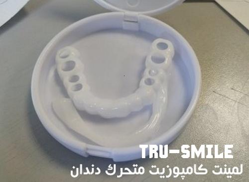 خرید لمینت کامپوزیت روکش قالب پلاک موقت متحرک دندان TruSmile 