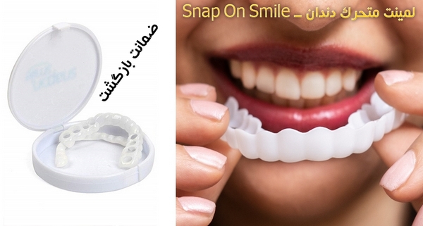 لمینت متحرک دندان - Snap On Smile