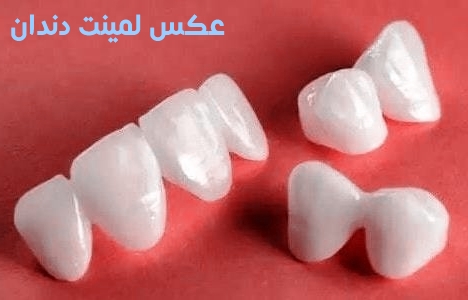 آیا ممکن است دندان های روکش دار حساس شوند؟