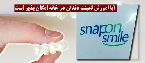 آیا اموزش لمینت دندان در خانه امکان پذیر است ؟