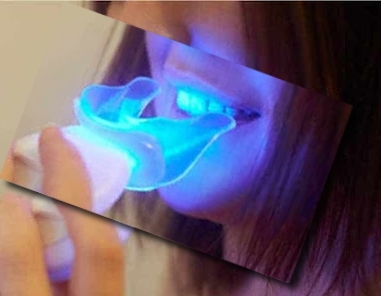 سفید کردن دندانها با نور فرا بنفش ابی چگونه کار می کند؟
